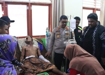 Kapolres SBT Jenguk Mahasiswa yang Luka Bakar Saat Demo di DPRD SBT
