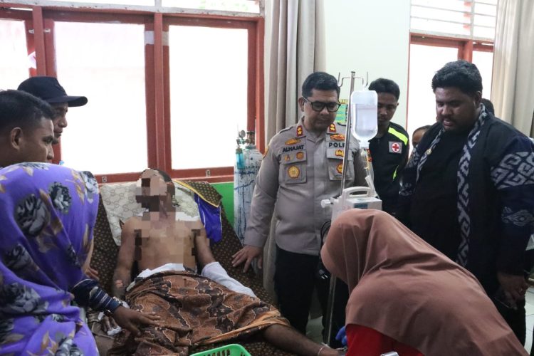 Kapolres SBT Jenguk Mahasiswa yang Luka Bakar Saat Demo di DPRD SBT
